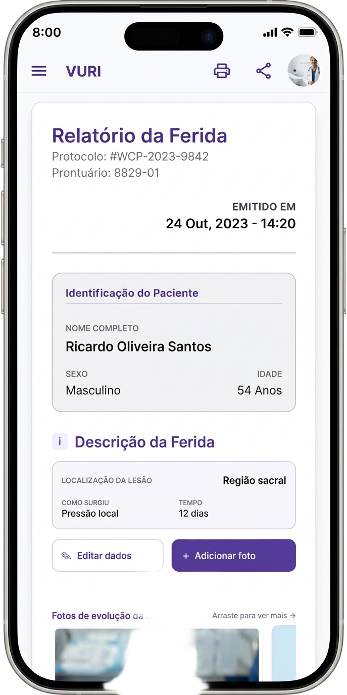 Écran de rapport de plaie dans l'app Vuri